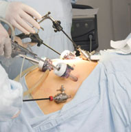 Gastric Surgery Weight Loss